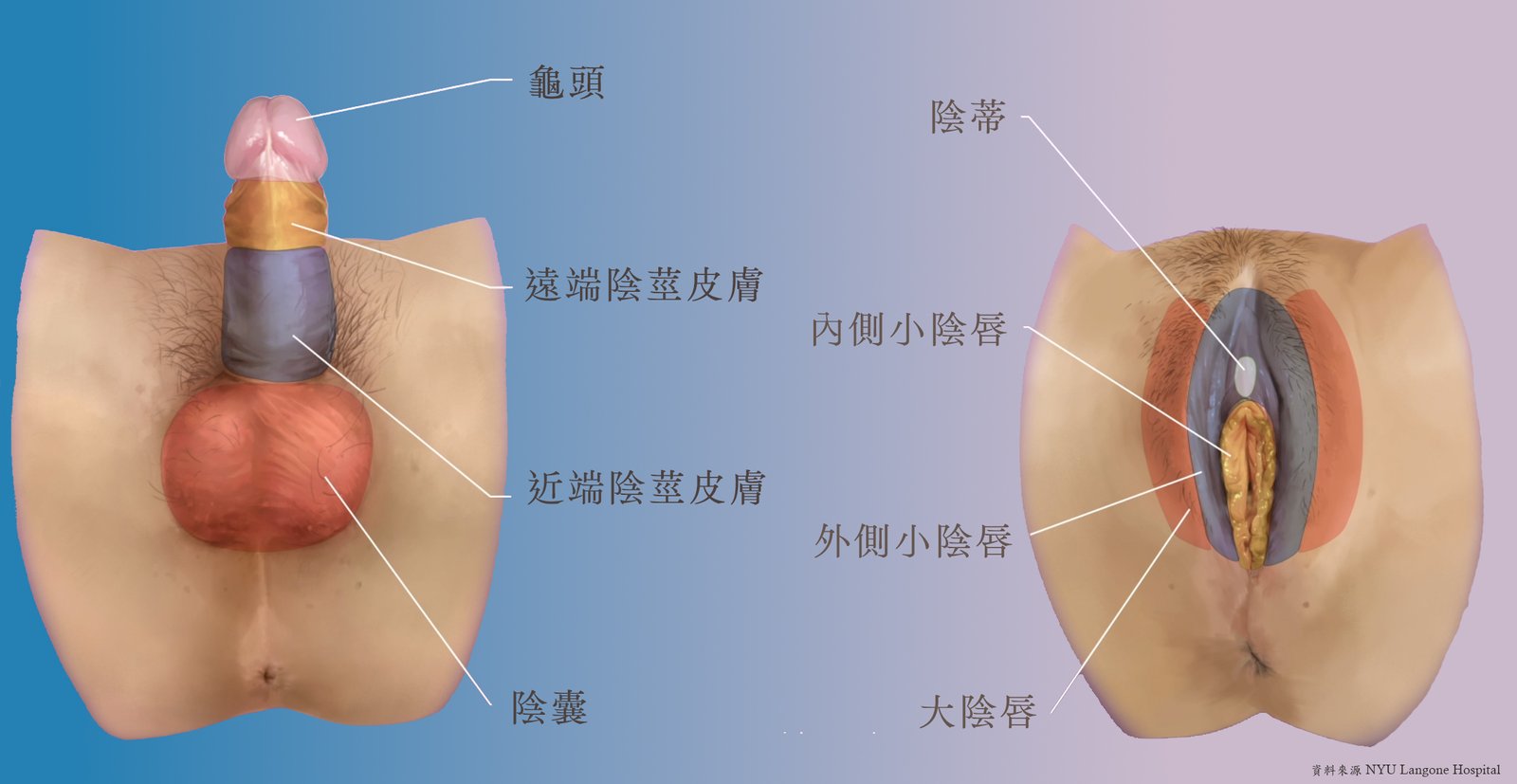 性別重置手術